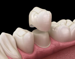 restorative dentistry Loveland