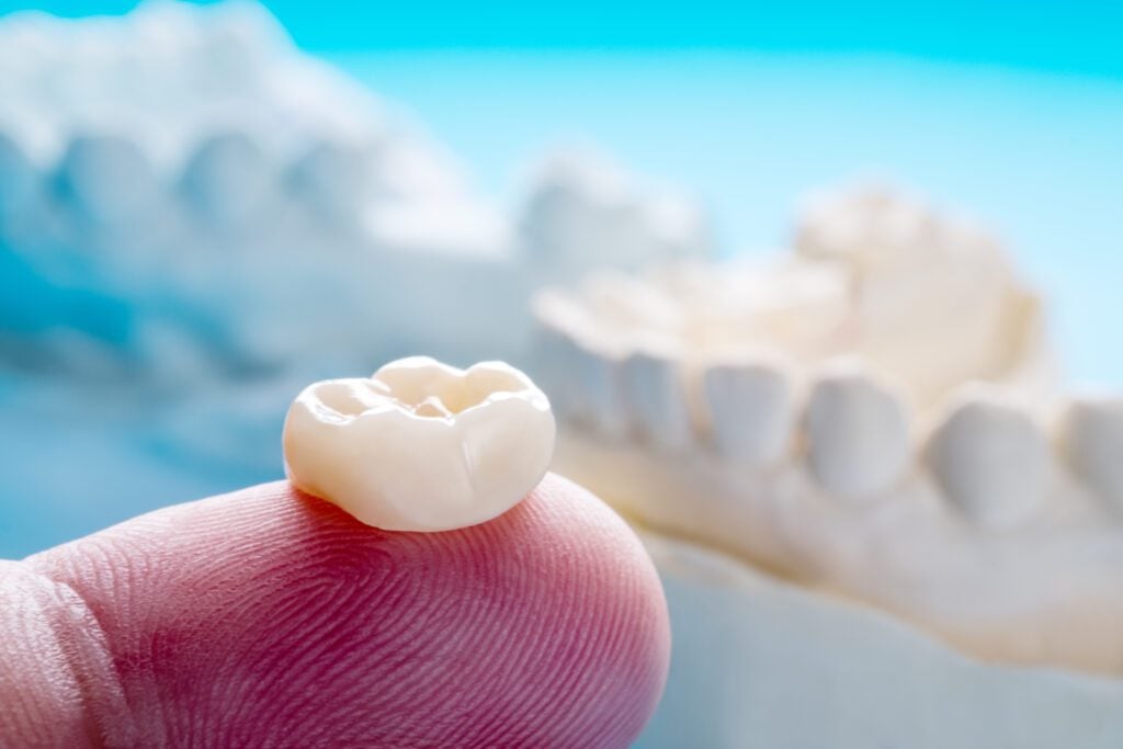 dental crowns in Berthoud