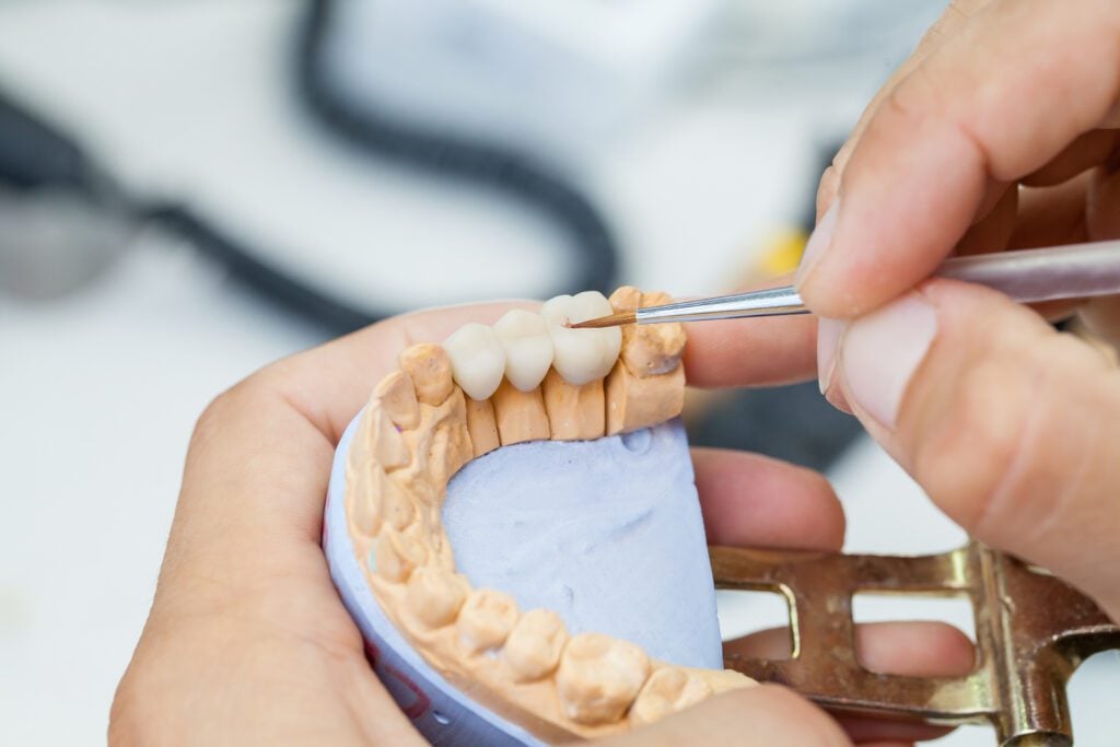 family dentist Berthoud, CO comprehensive dentistry in Loveland